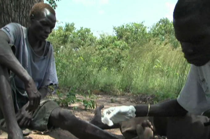Guinea worm still