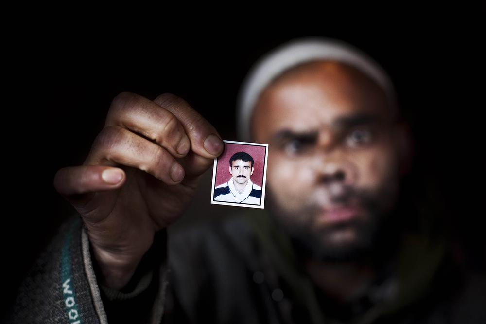 <p>Mehraj-u-Din Peer (35) of Rafiabad in Baramulla was disfigured after being brutally mauled by a Himalayan Black Bear in May 2005 while he was working in his field</p>