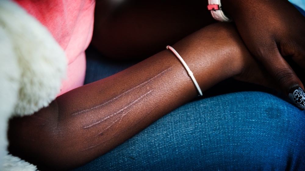 Xandra says she has been left feeling suicidal at times and has little regard for her body [Mona van den Berg]