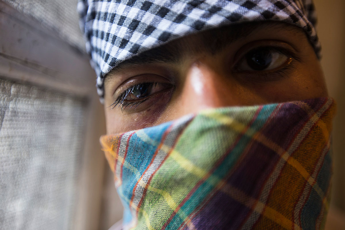 Pellet Injuries/ Please Do Not Use