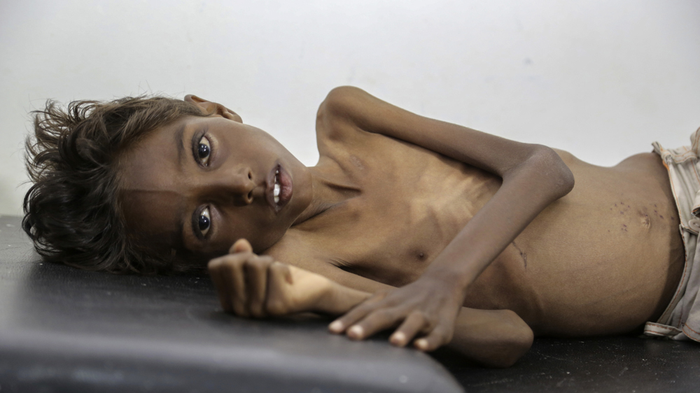 Yemen