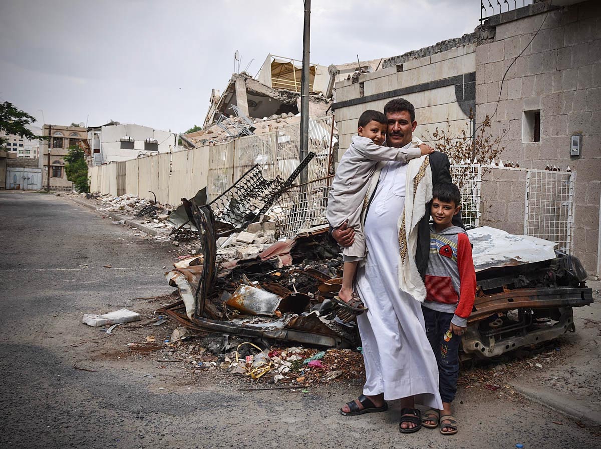 Yemen’s manmade hell /Please Do Not Use