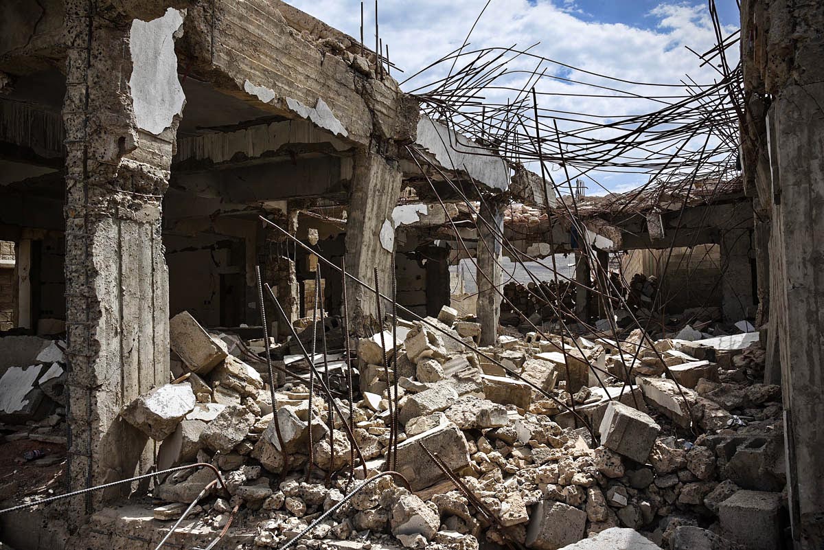 Yemen’s manmade hell /Please Do Not Use