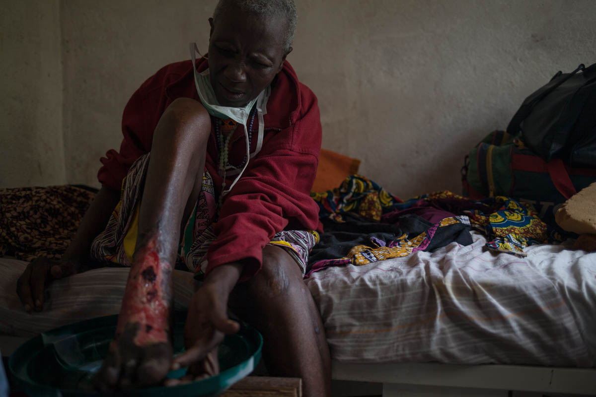 Marie-Jeanne Lemale, examines her wound and gives instructions to the nurse who redoes her dressing "you didn''t see the hole here" or "you forgot the oil there", she specifies. At the hospital for the