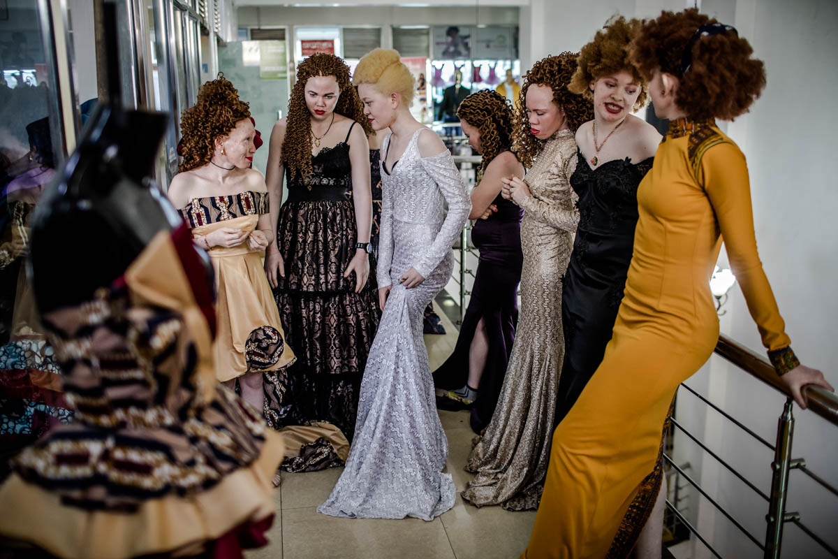 East Africa albino beauty pageant aims to fight social stigma