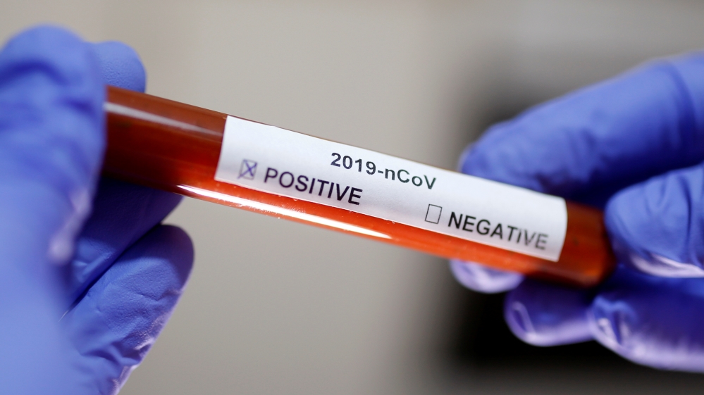 Test tube with Corona virus name label is seen in this illustration picture