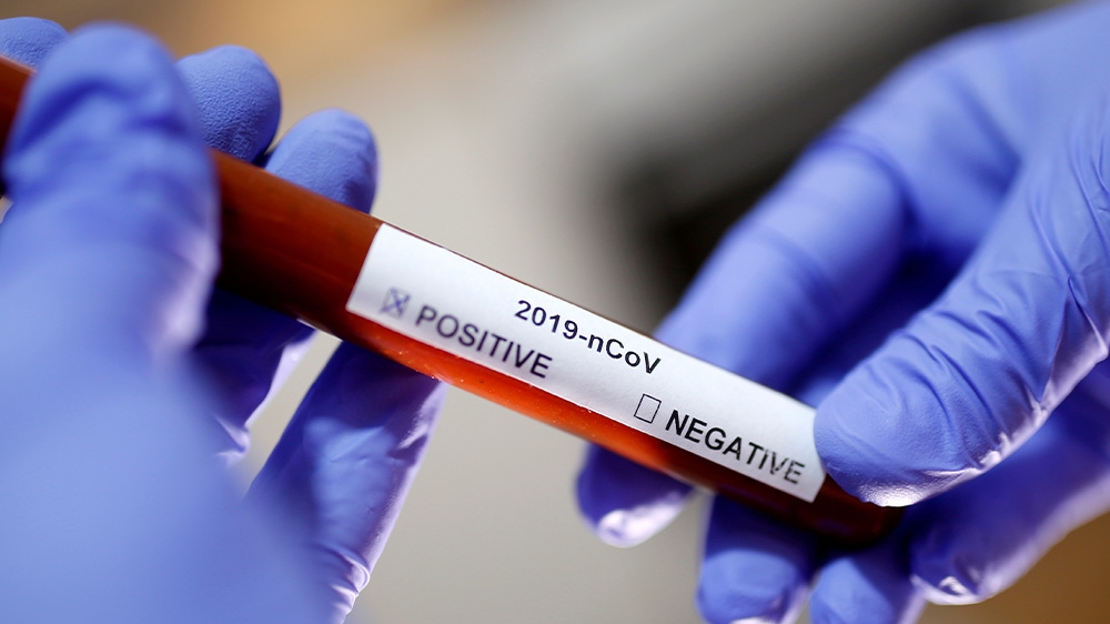 Test tube with Coronavirus name label is seen in this illustration taken on January 29, 2020