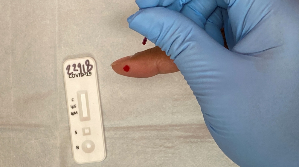 antibody testing
