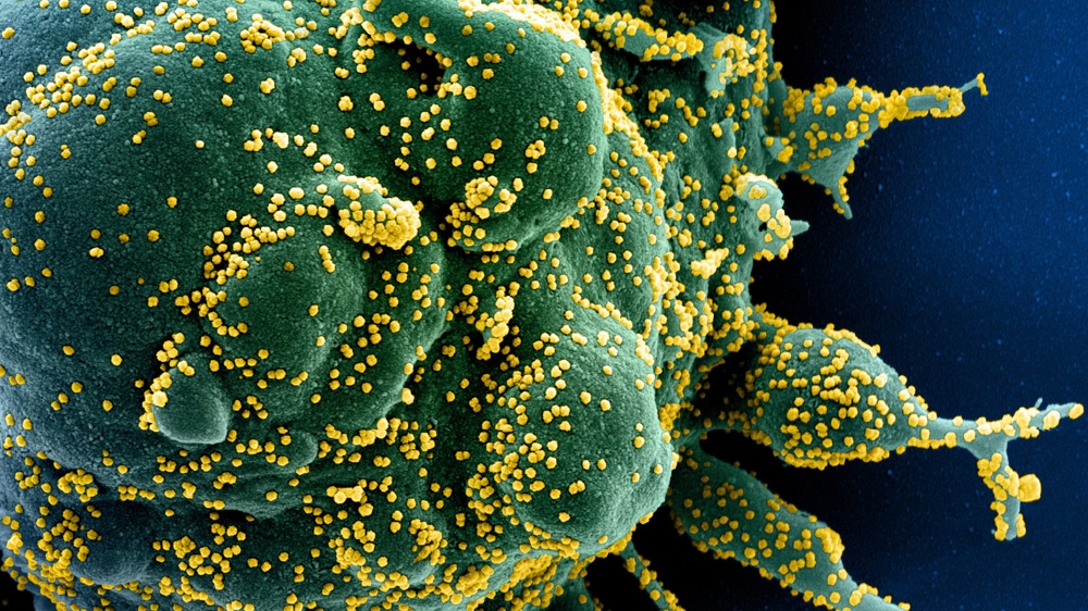 A colourised scanning electron micrograph of an apoptotic cell (green) infected with SARS-COV-2 virus particles (yellow) isolated from a patient sample, captured at the NIAID Integrated Research Facility (IRF) in the US