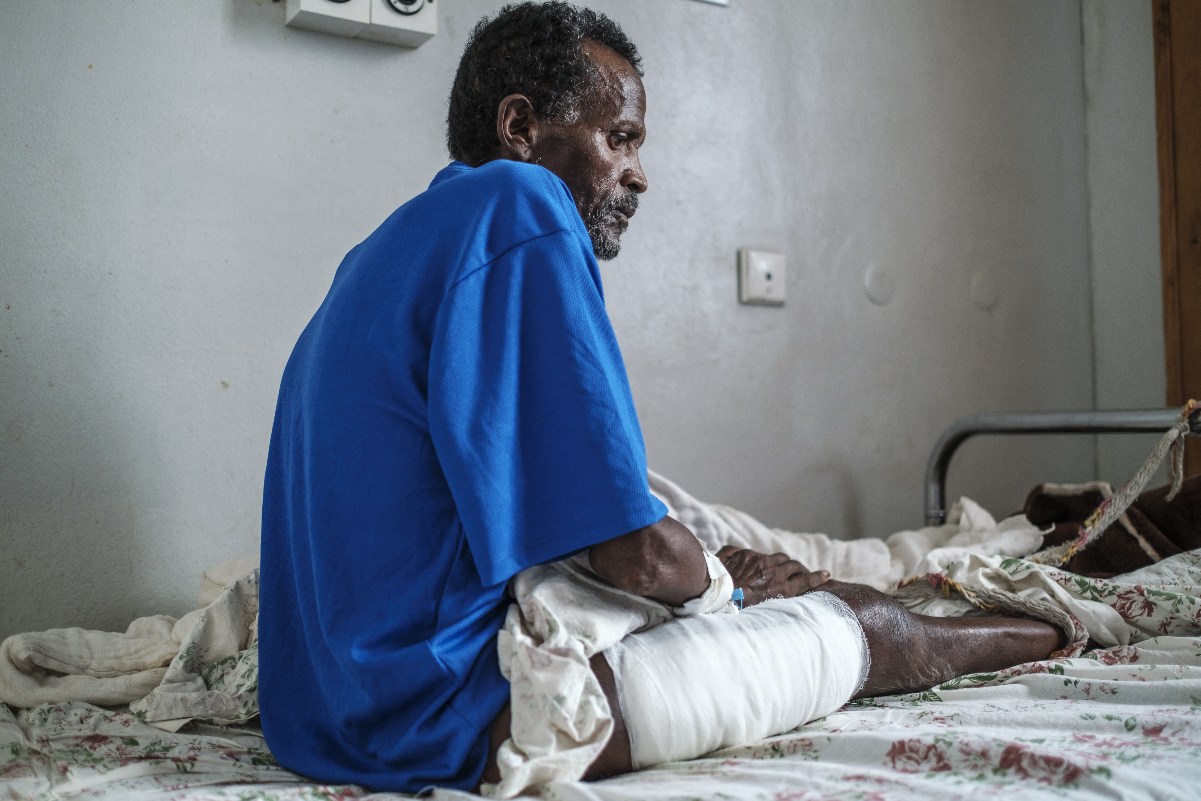 Tamrat Kidanu, 66, a survivor of the massacre of Dengolat, sits on his bed at the Ayder Referral Hospital in Mekelle, the capital of Tigray on February 26, 2021