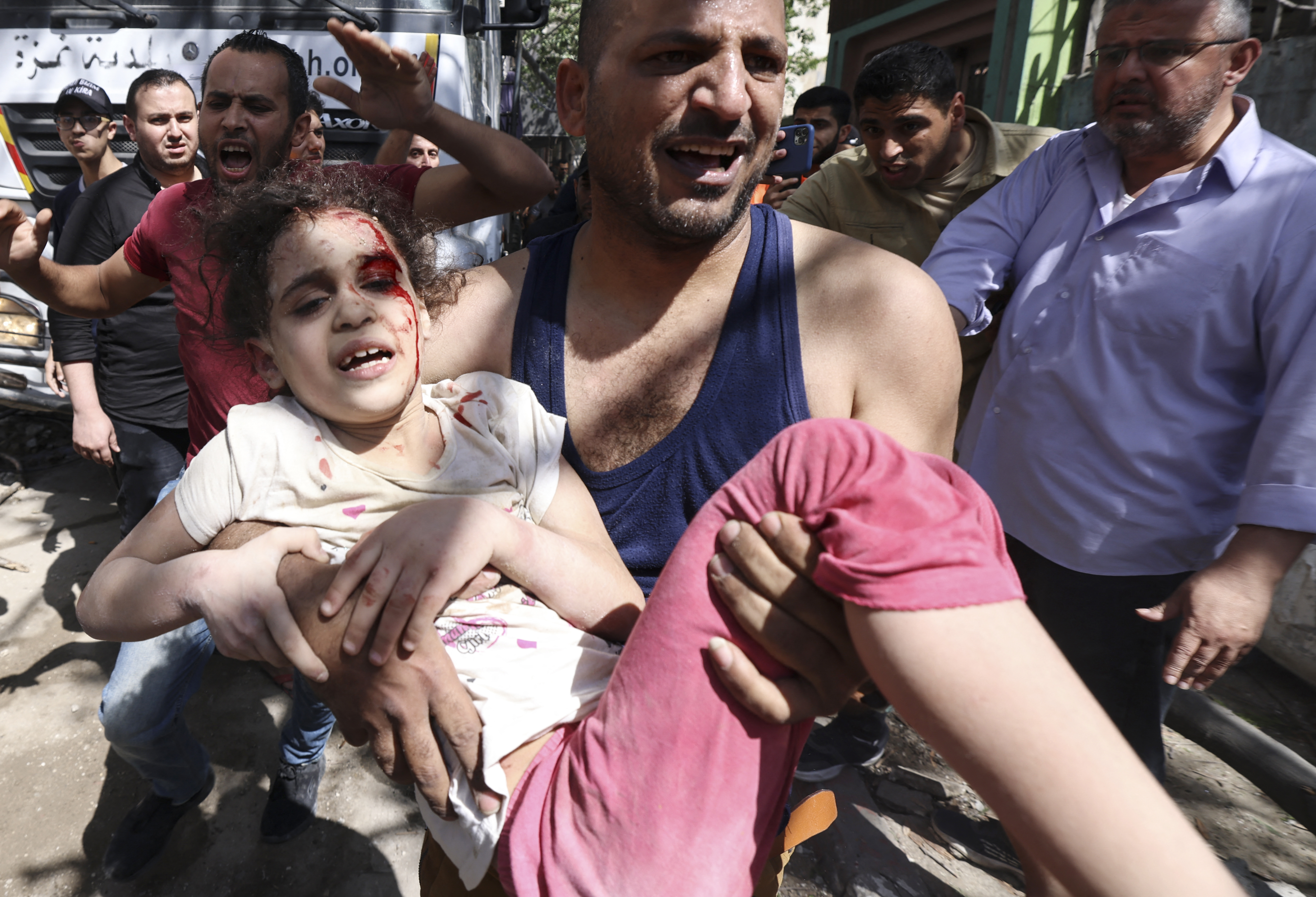 Palestinians evacuate a wounded girl from the debris of a destroyed building in Gaza City