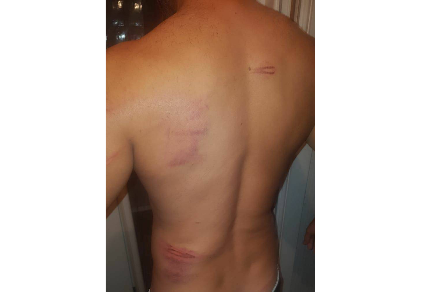Joel, a Cuban national, says he was beaten up by Greek officers during detainment and expulsion into Turkey [Courtesy: Joel]