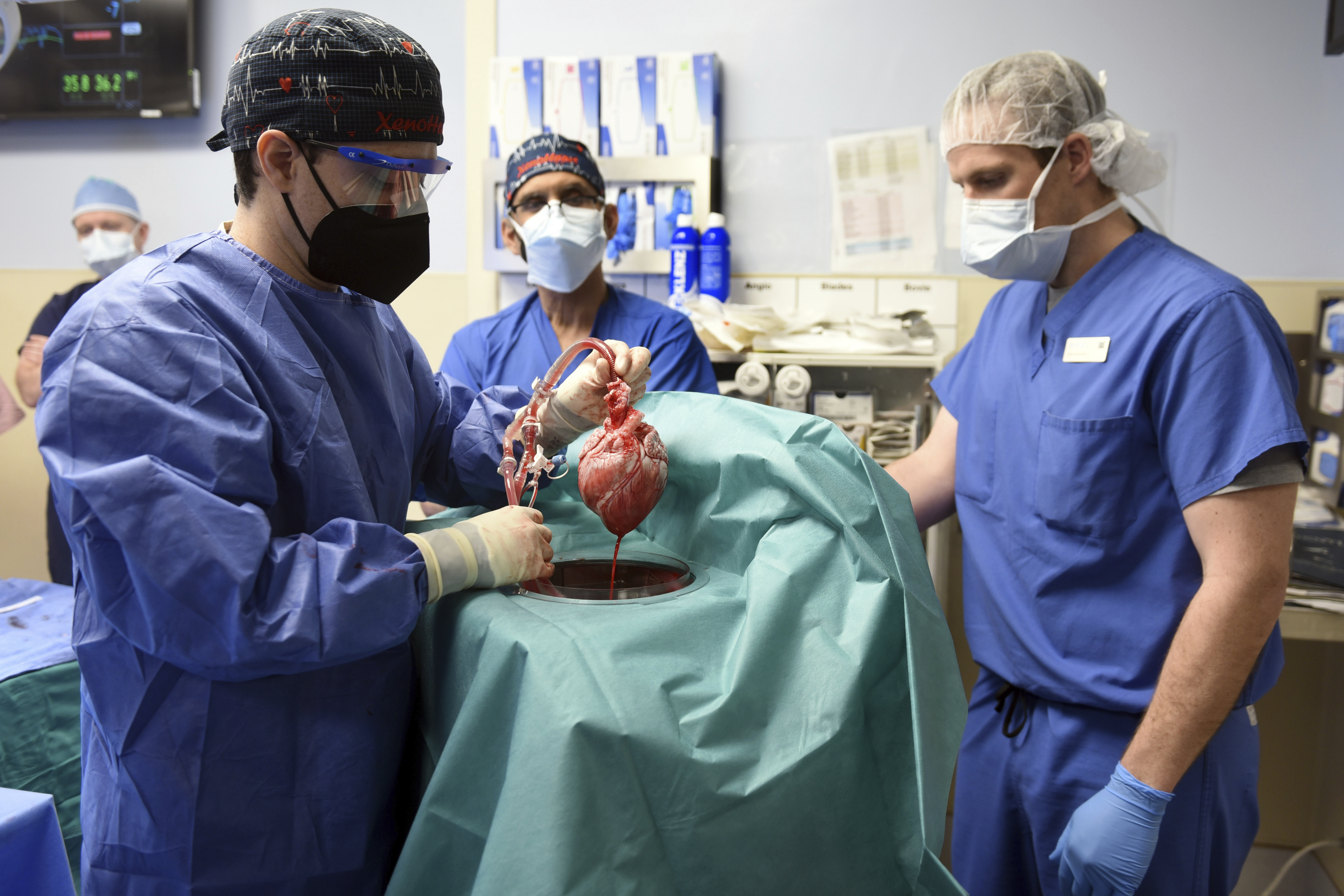 Pigs have long been used in human medicine, including pigskin grafts and implantation of pig heart valves – but transplanting entire organs is much more complex than using highly processed tissue