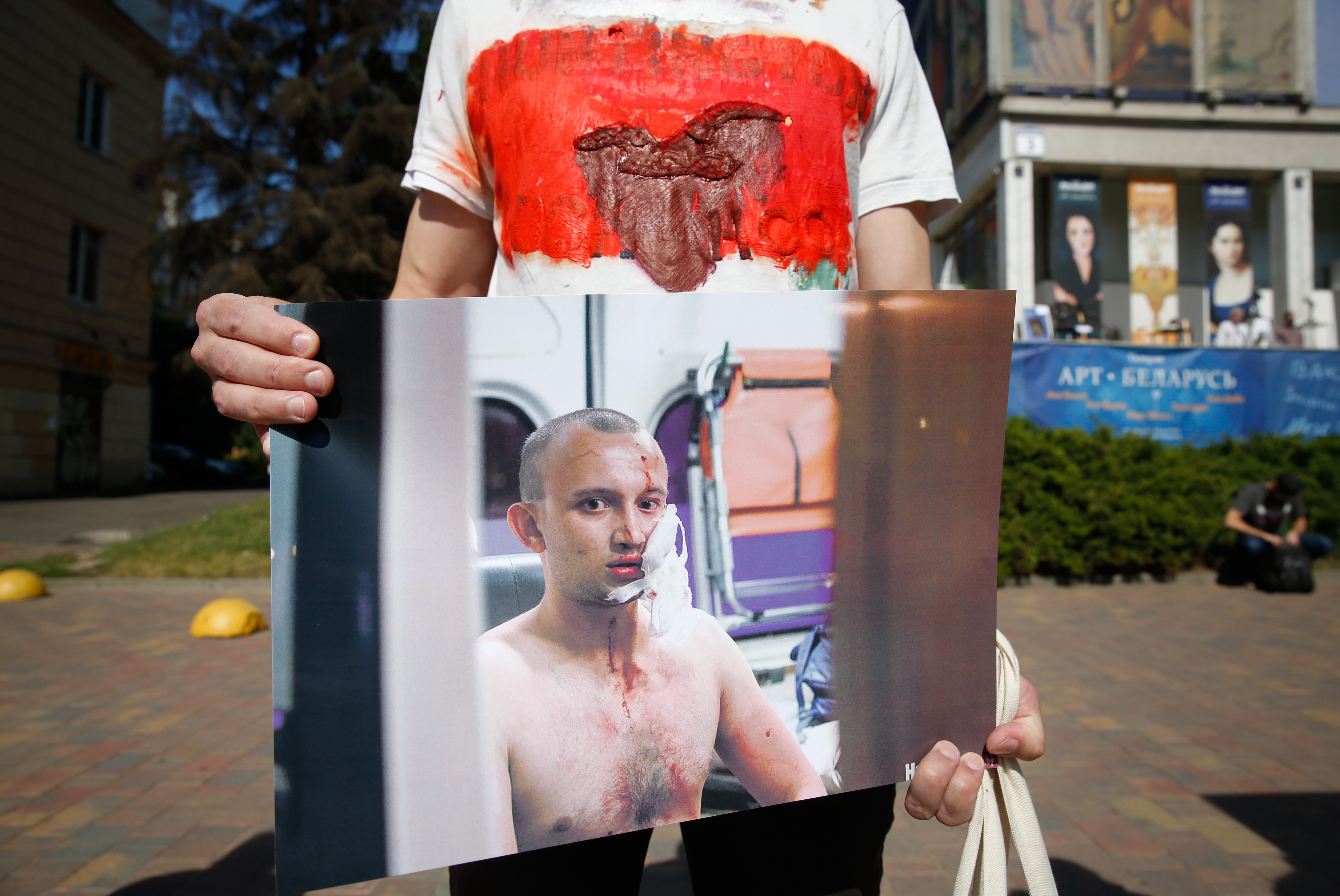 A Belarusian man at a rally in Minsk holds pictures of a person reportedly beaten by the police in a detention centre