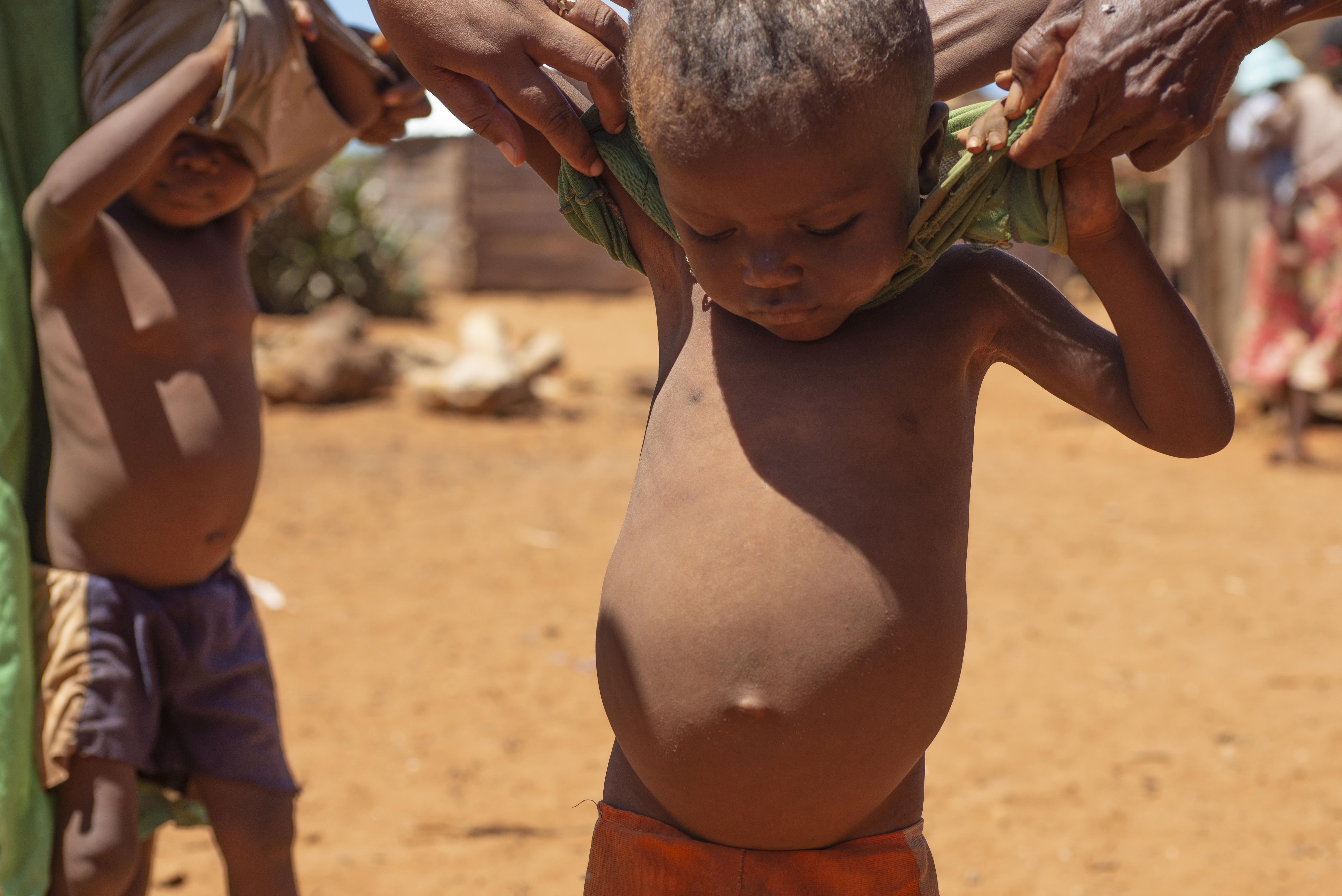 Madagascar hunger
