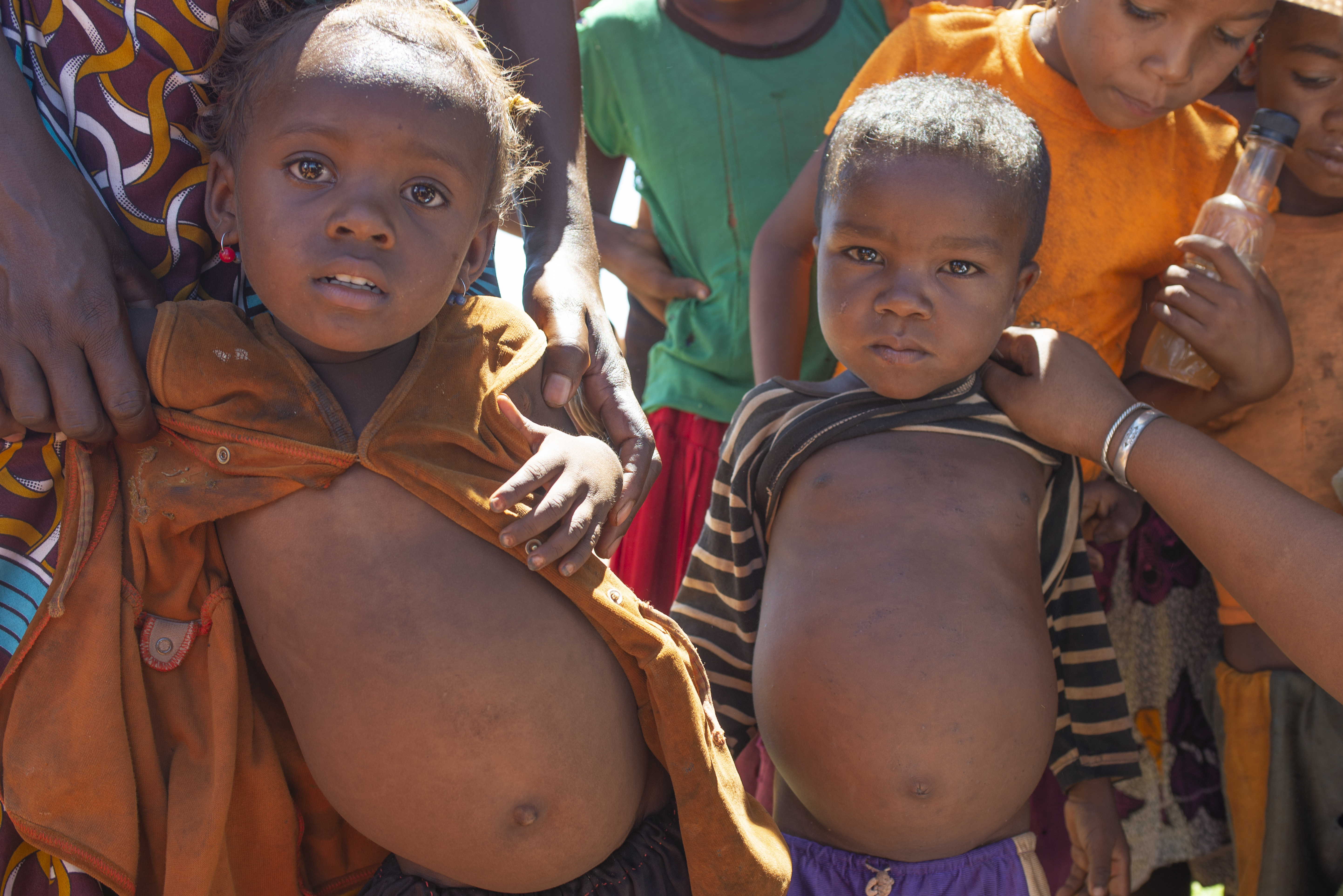 Madagascar Hunger