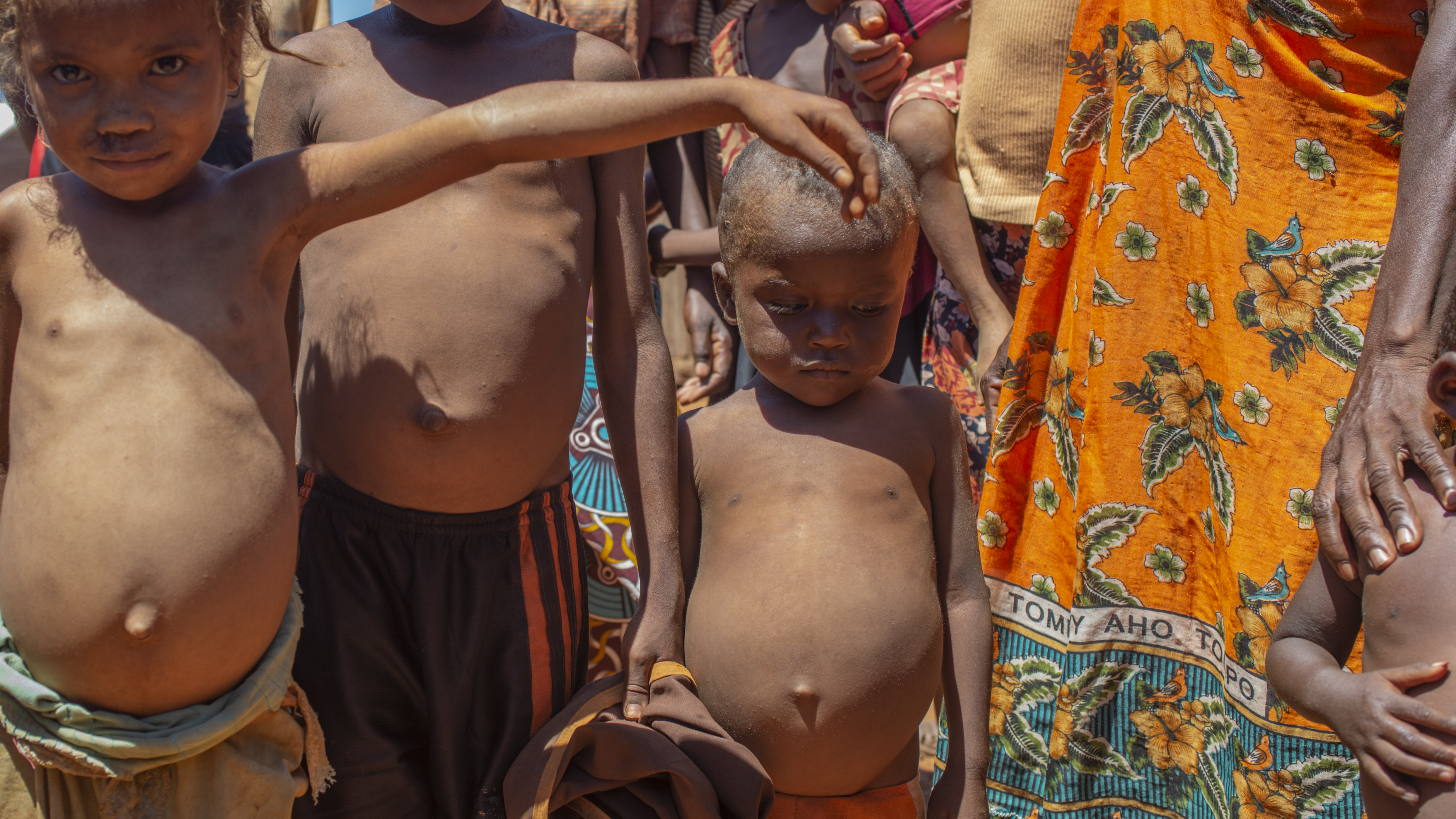 Madagascar hunger