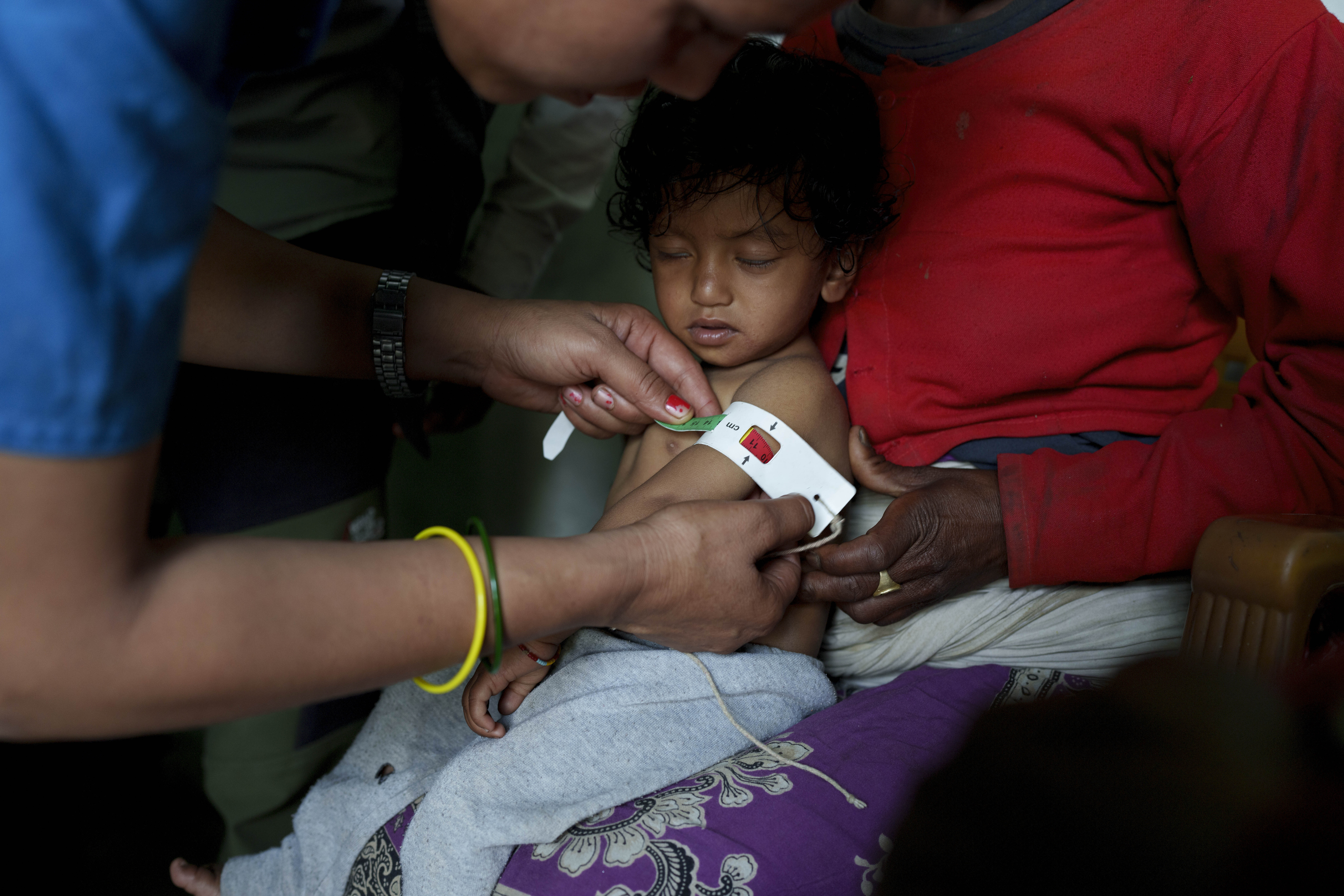 A Health worker measures the circumference of the mid-arm of a malnourished child