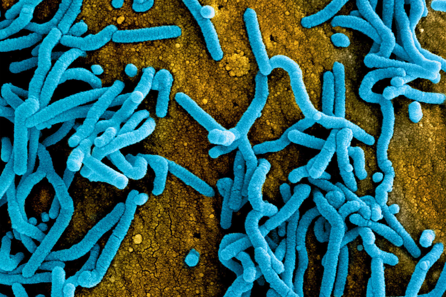 Colorized scanning electron micrograph of Marburg virus particles