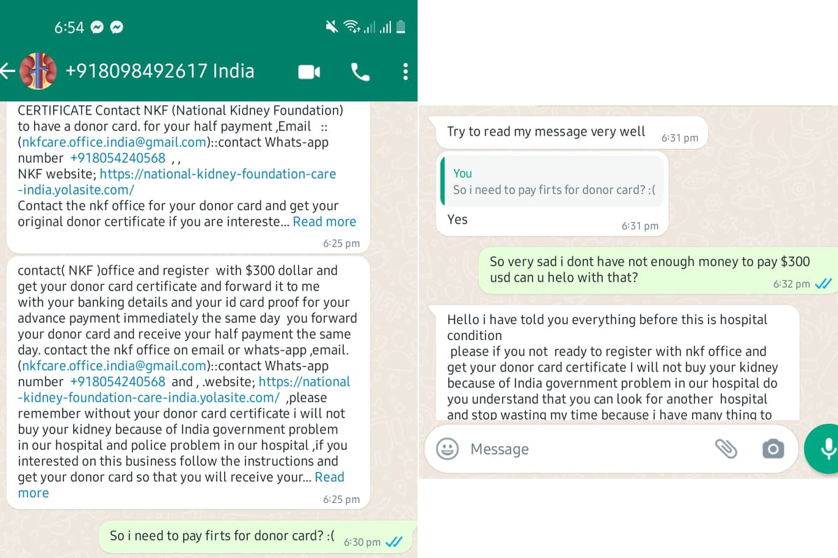 kidney donors scam