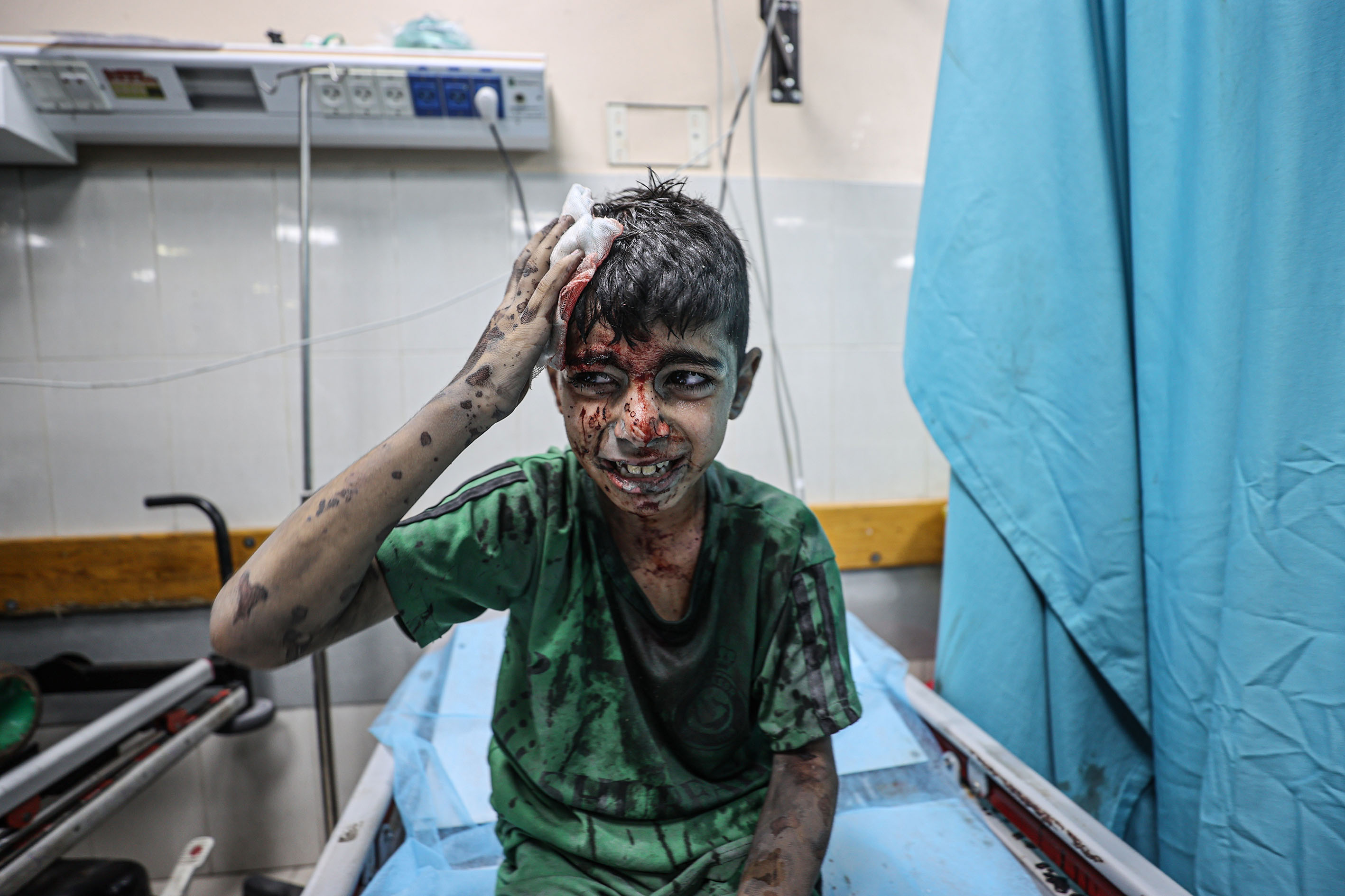 An injured Palestinian boy sits on a stretcher waiting to receive medical care at Nasser Hospital after an Israeli air strike in Khan Younis, Gaza, on October 26, 2023