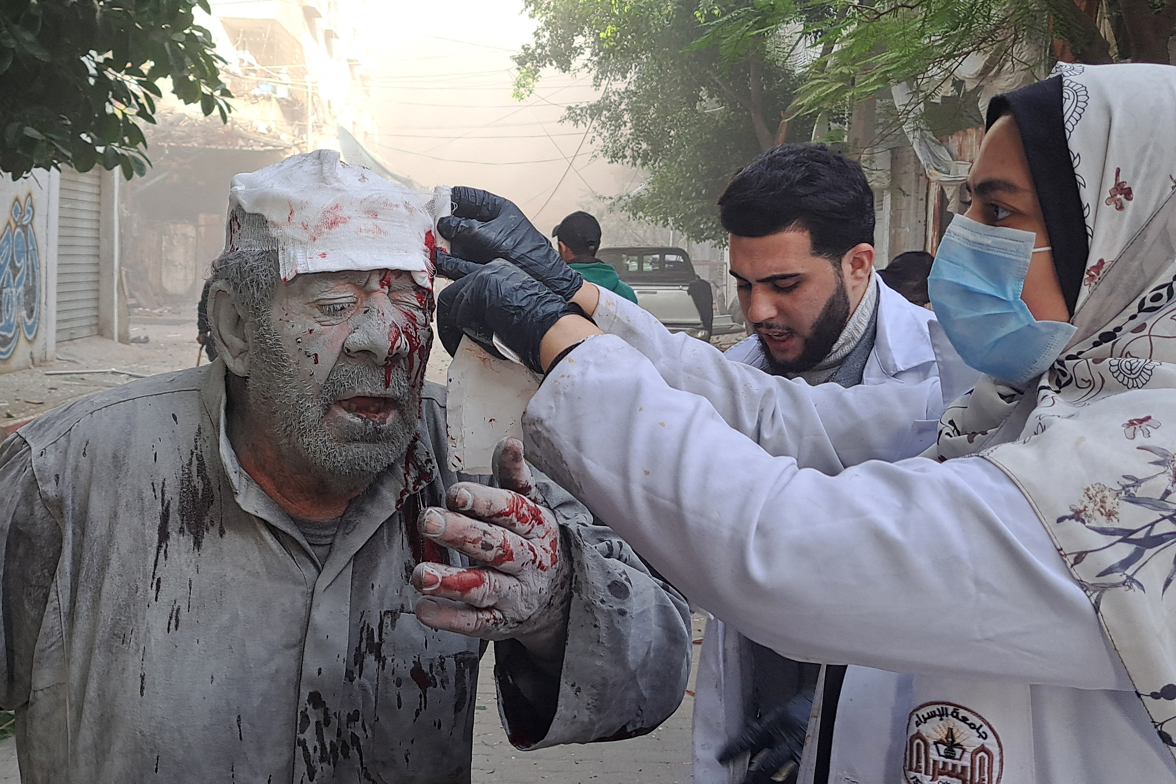 A Palestinian man receives treatment after an Israeli strike near the Kamal Adwan hospital in Beit Lahiya in the northern Gaza Strip on November 22, 2023