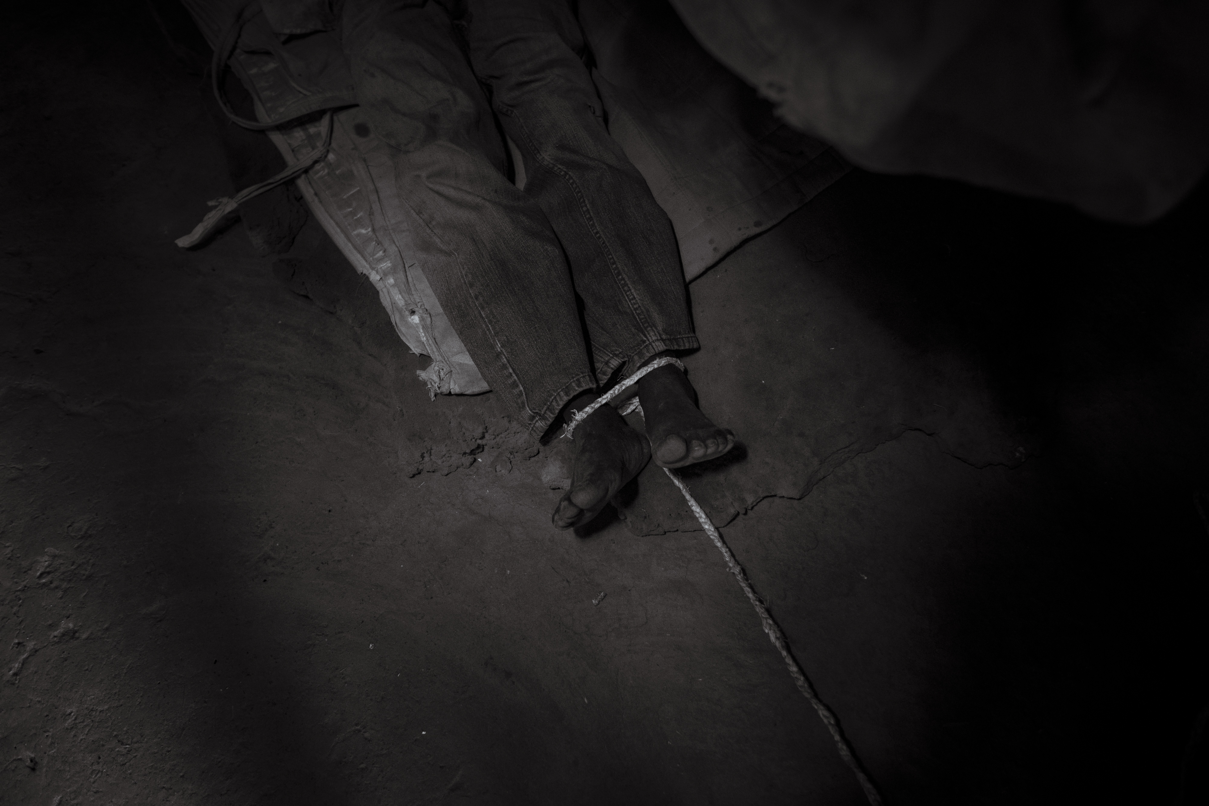 Sam Otelai, 20, is often violent towards himself, his family and others in the local community. His father Moses has resorted to tying him up for his own safety