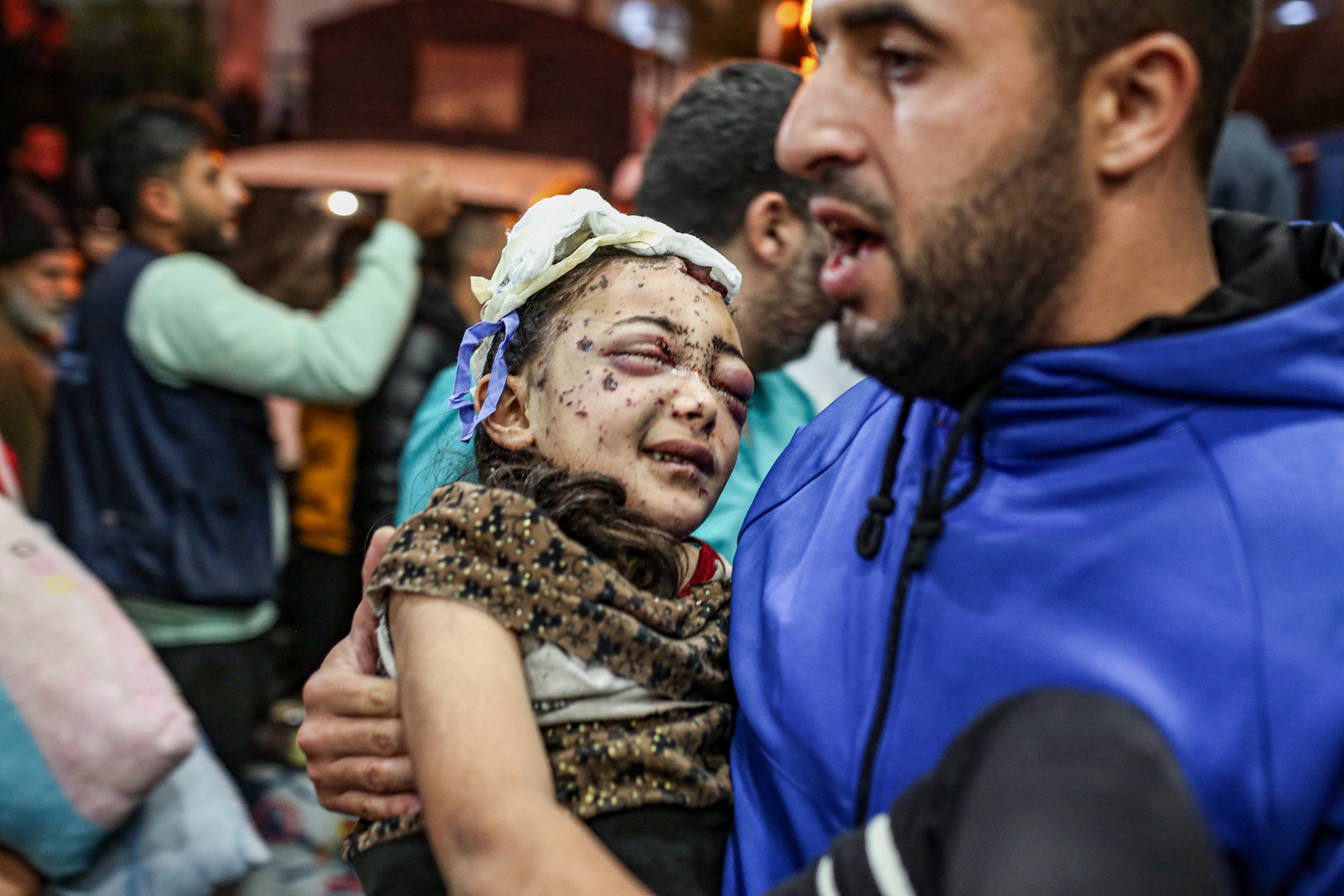 Injured Palestinians evacuated from the Indonesian hospital in the north of the Gaza Strip receive care at Nasser hospital in the Palestinian territory's southern city of Khan Yunis.