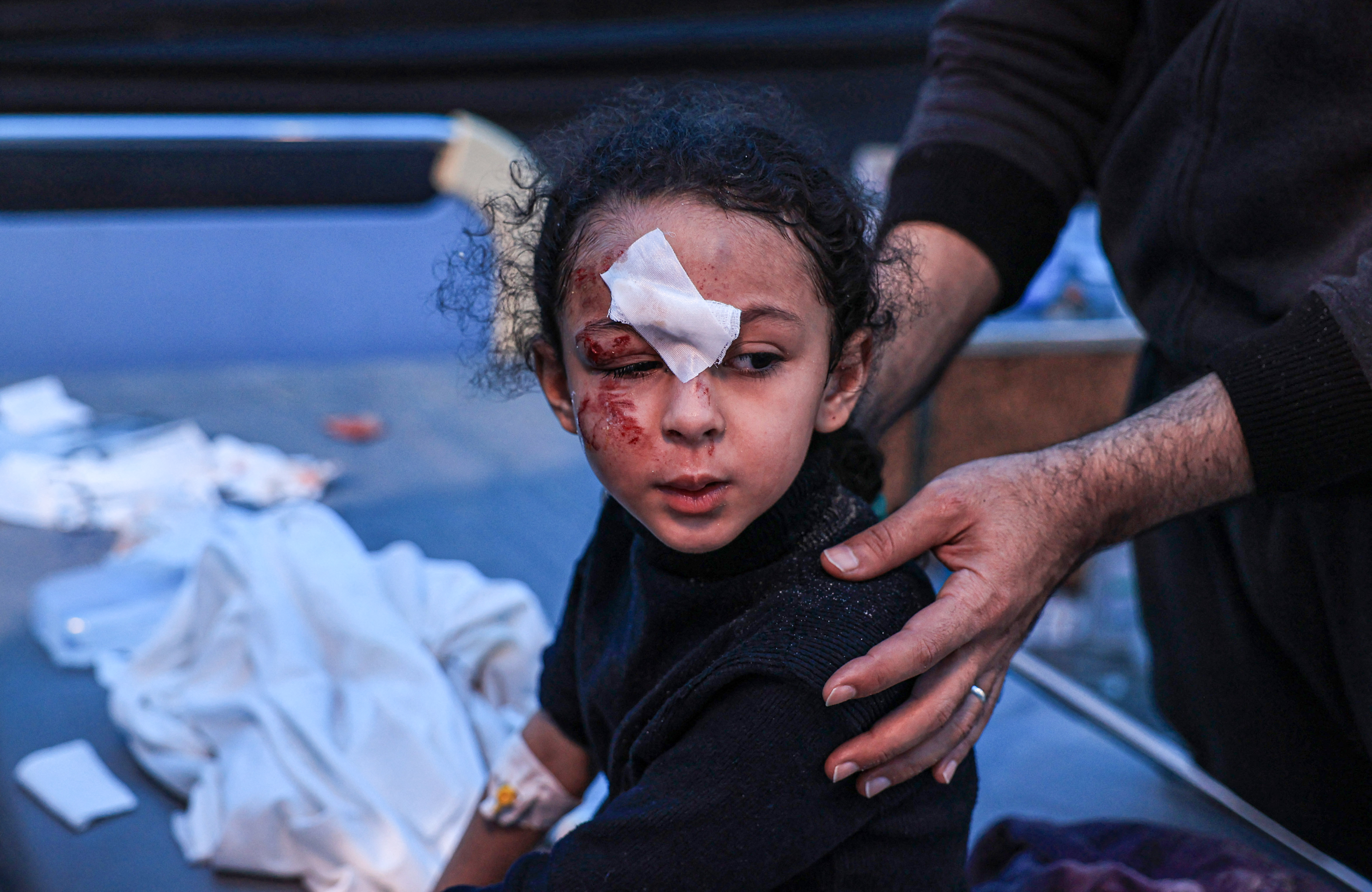 A child injured during Israeli bombardment receives treatment at the Kuwait Hospital in Rafah in the southern Gaza Strip.