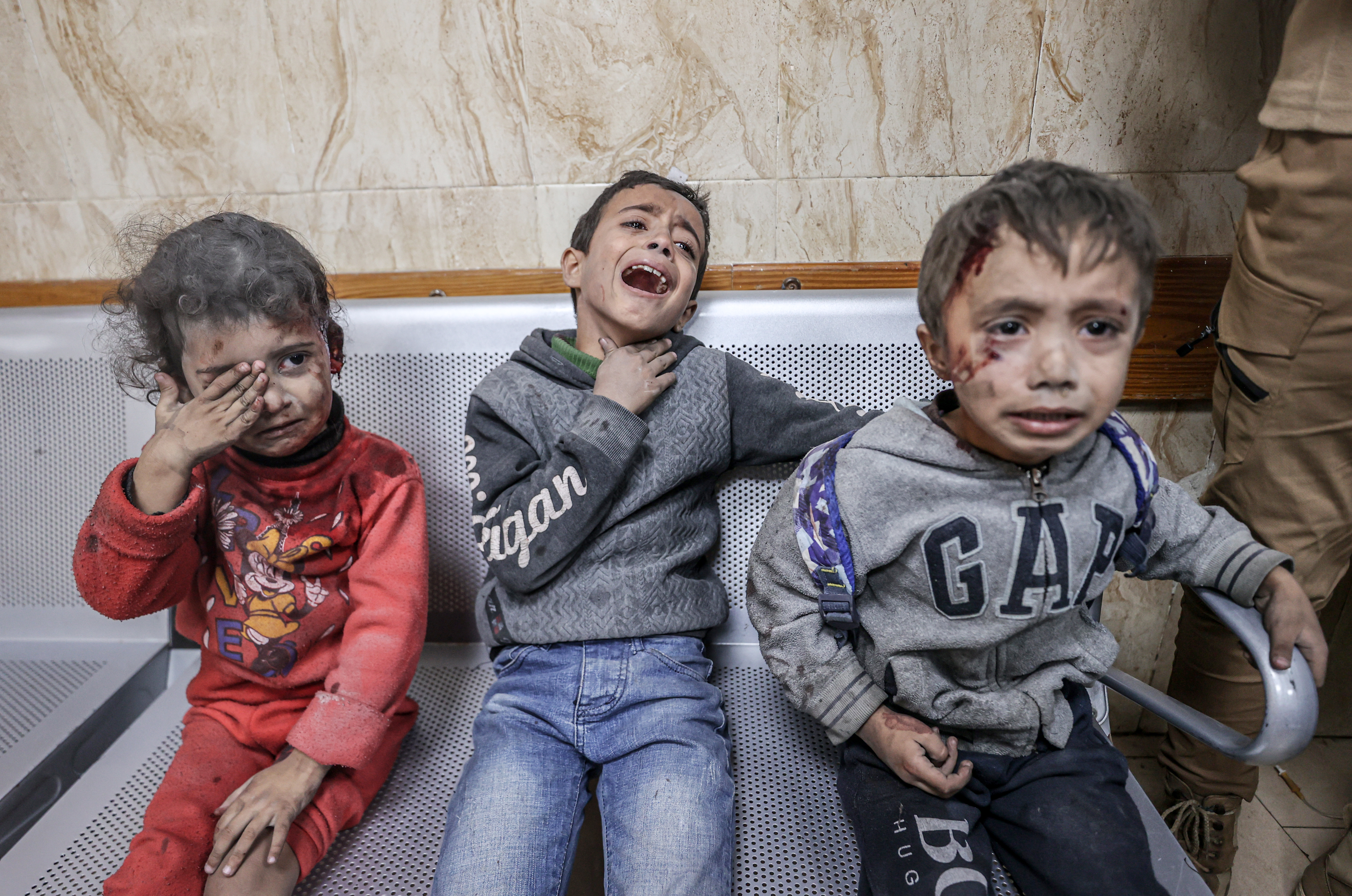 Injured people, including children, are brought to Al-Aqsa Martyrs Hospital for treatment.