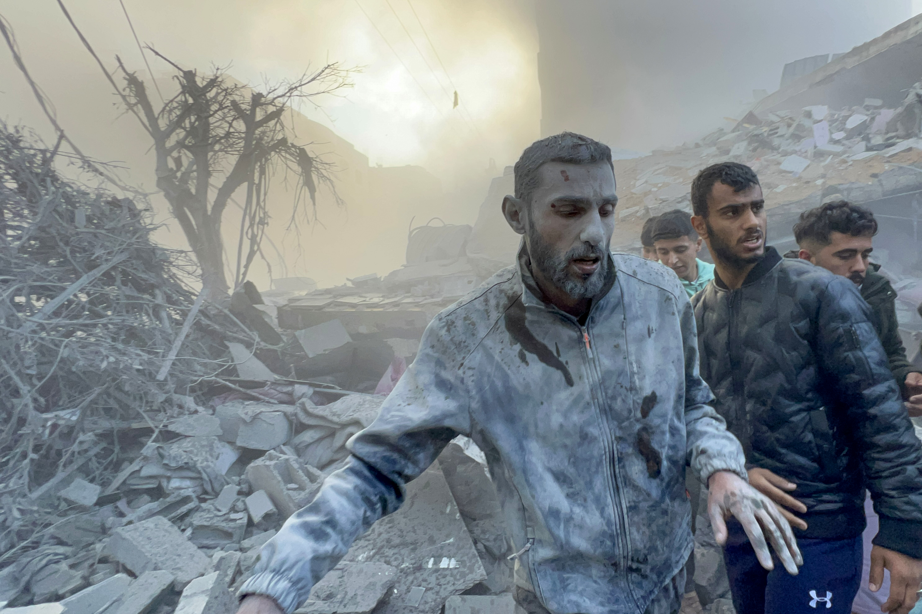 A wounded man walks away after the Israeli airstrikes hit a residential building and caused casualties in Tal al-Zaatar area