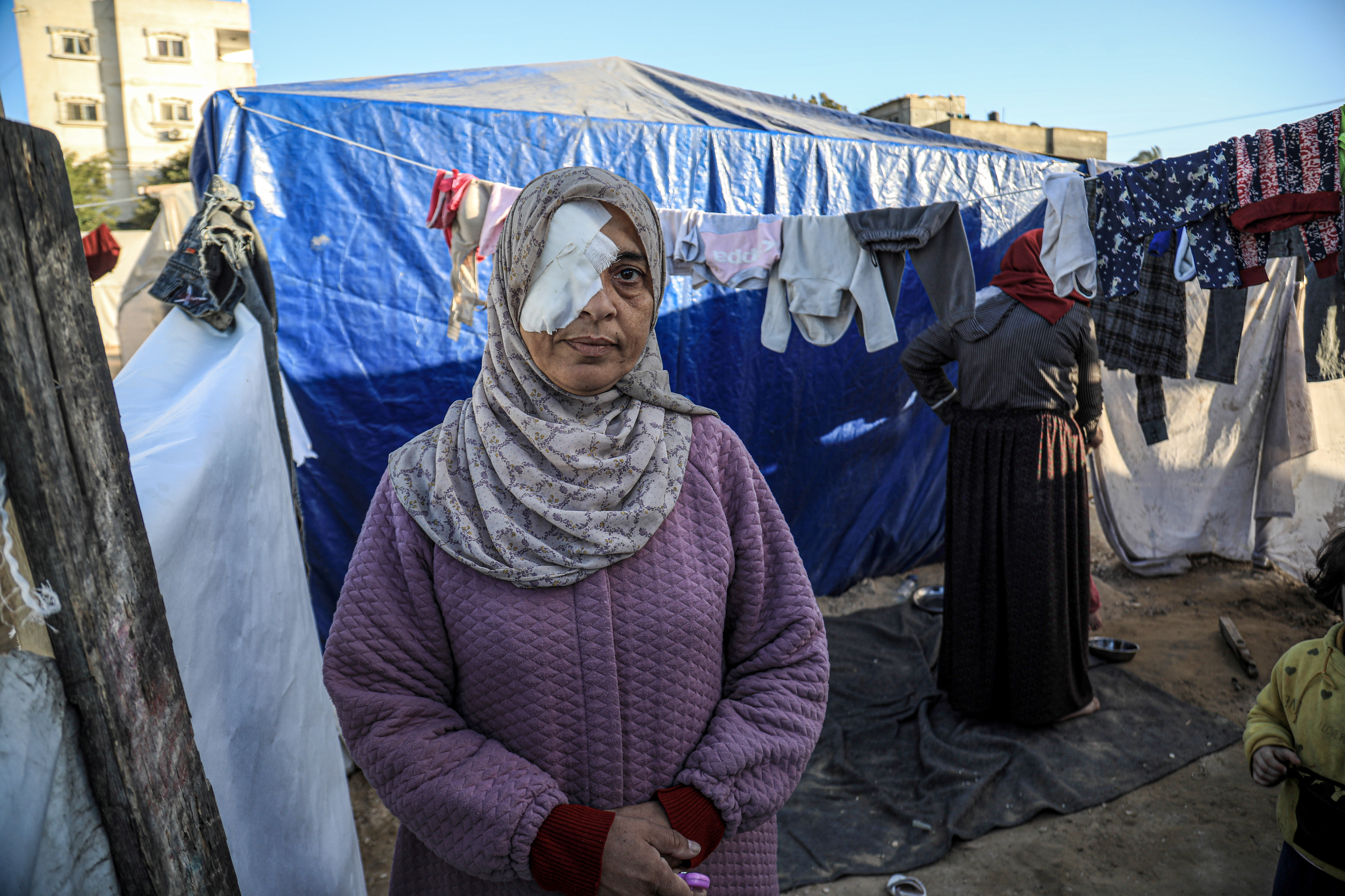 Sawsan Al-Zein, 50, lost an eye during an Israeli bombing that destroyed her home near Gaza City at the start of the war