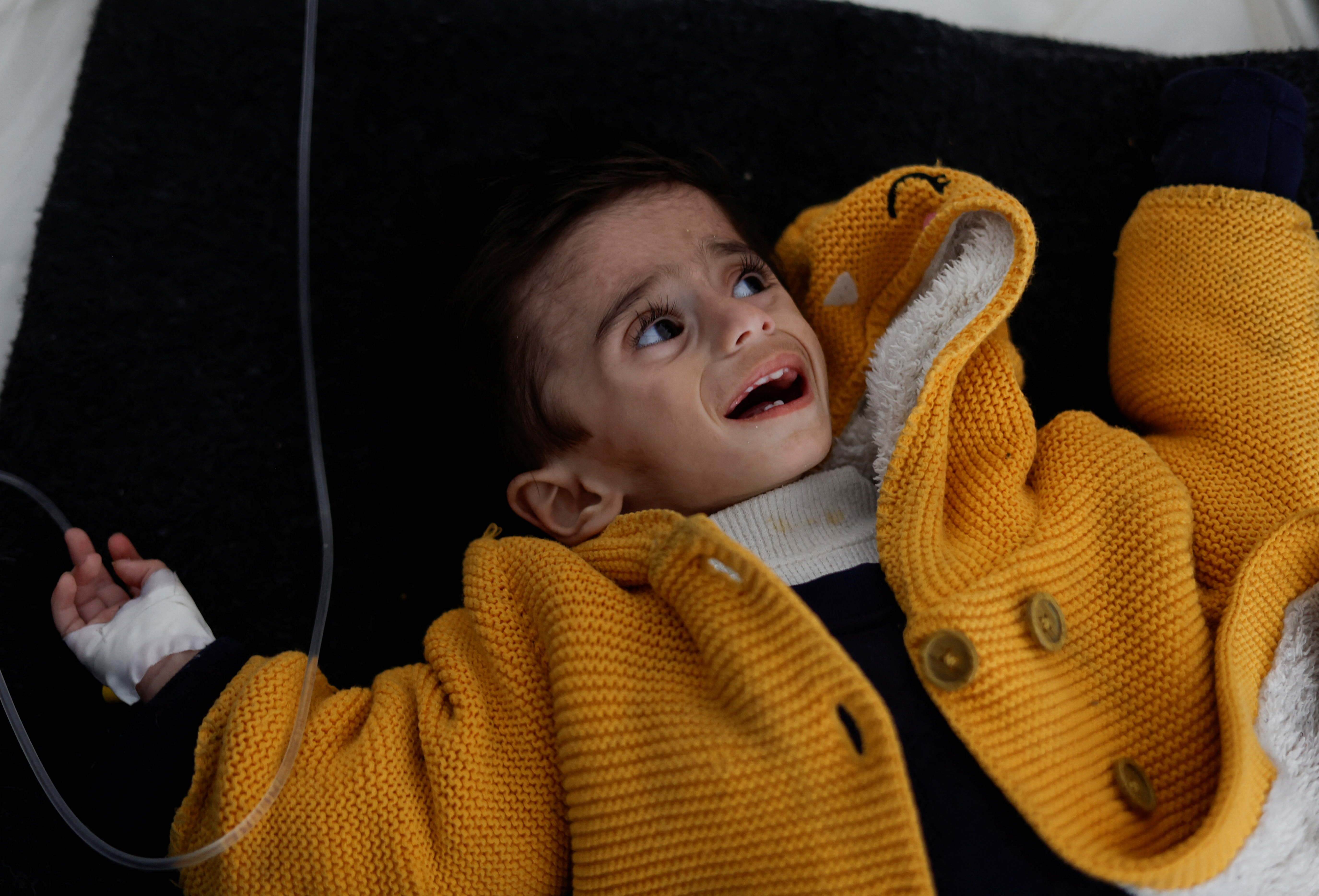 Crying child in a yellow sweater