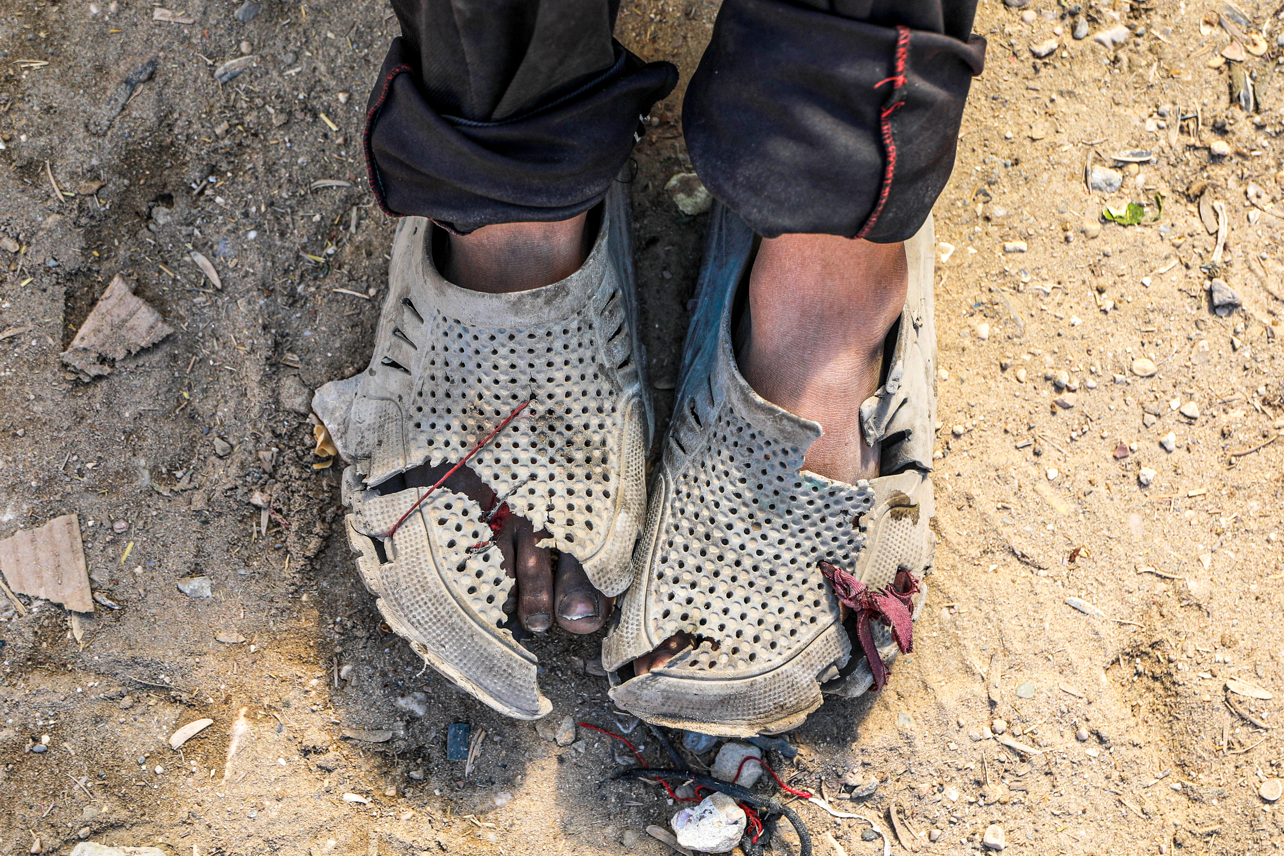 A child's feet in tattered shoes because his parents cannot find shoes or clothes for him in Gaza as Israel bombs civilians there