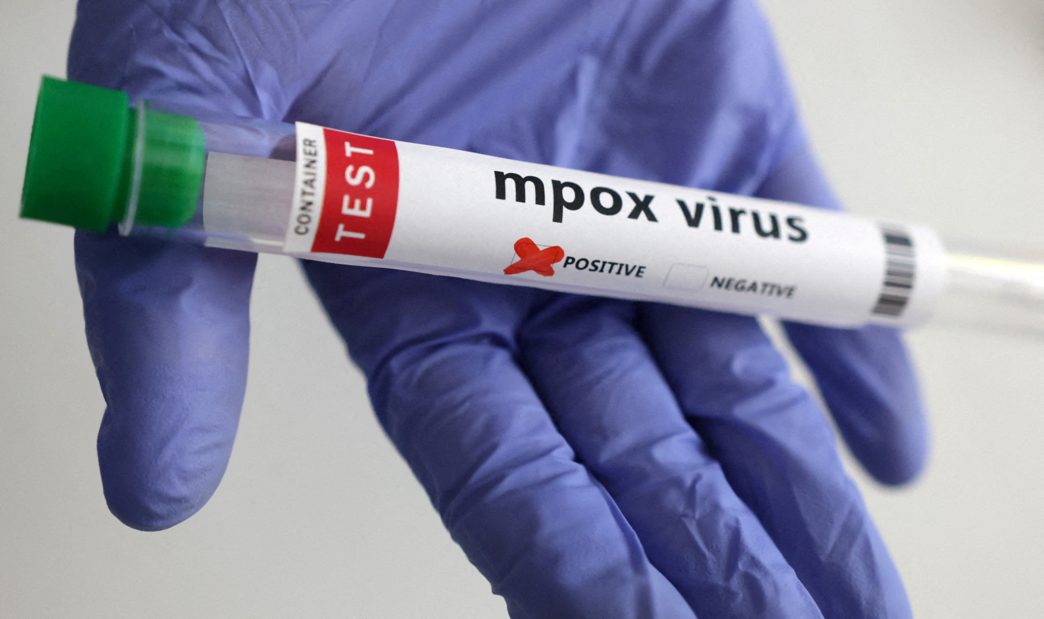 mpox
