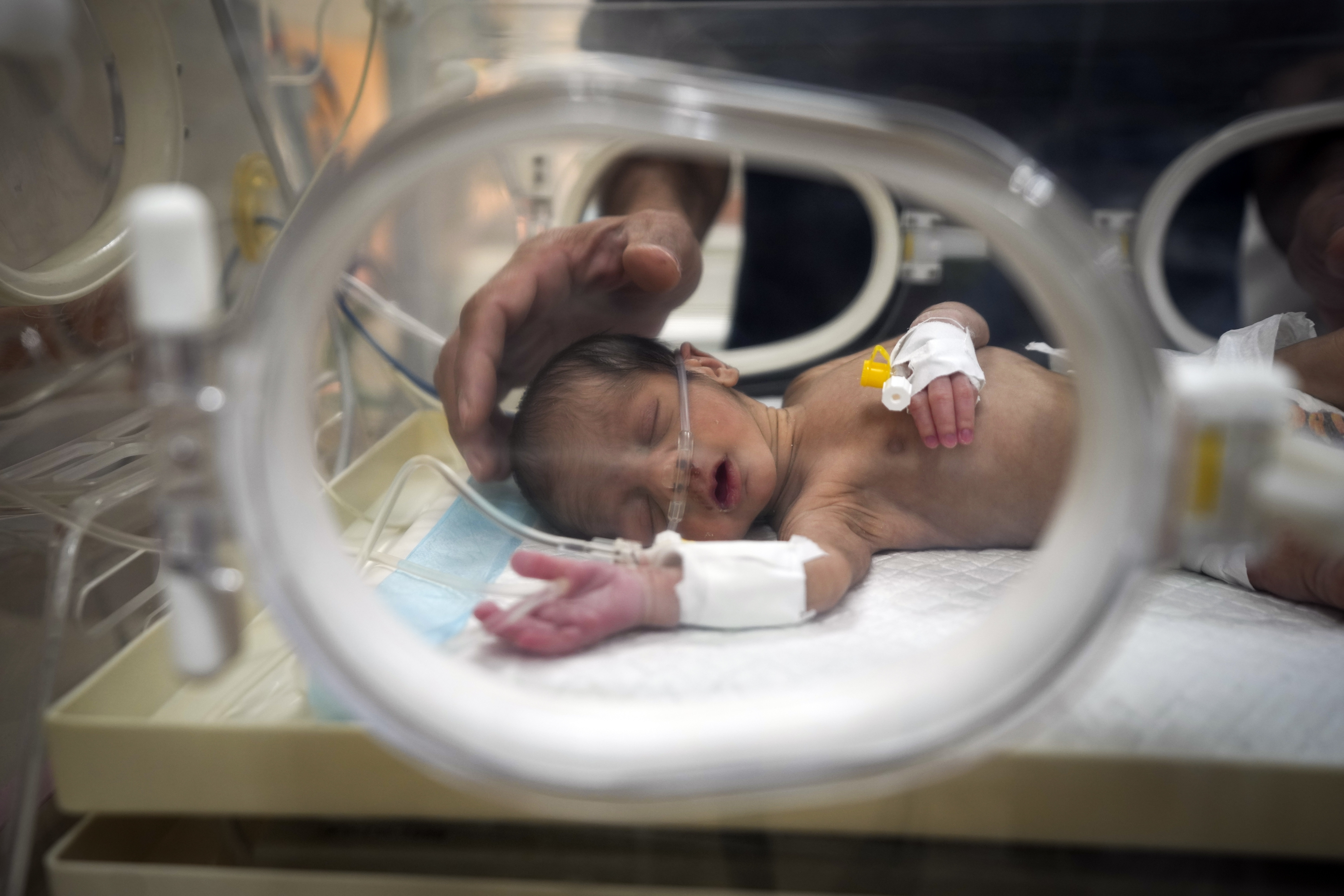 Ali al-Batran, a 20-day-old infant, lies in the intensive care unit with hypothermia at Al-Aqsa Martyrs Hospital in Deir el-Balah, central Gaza