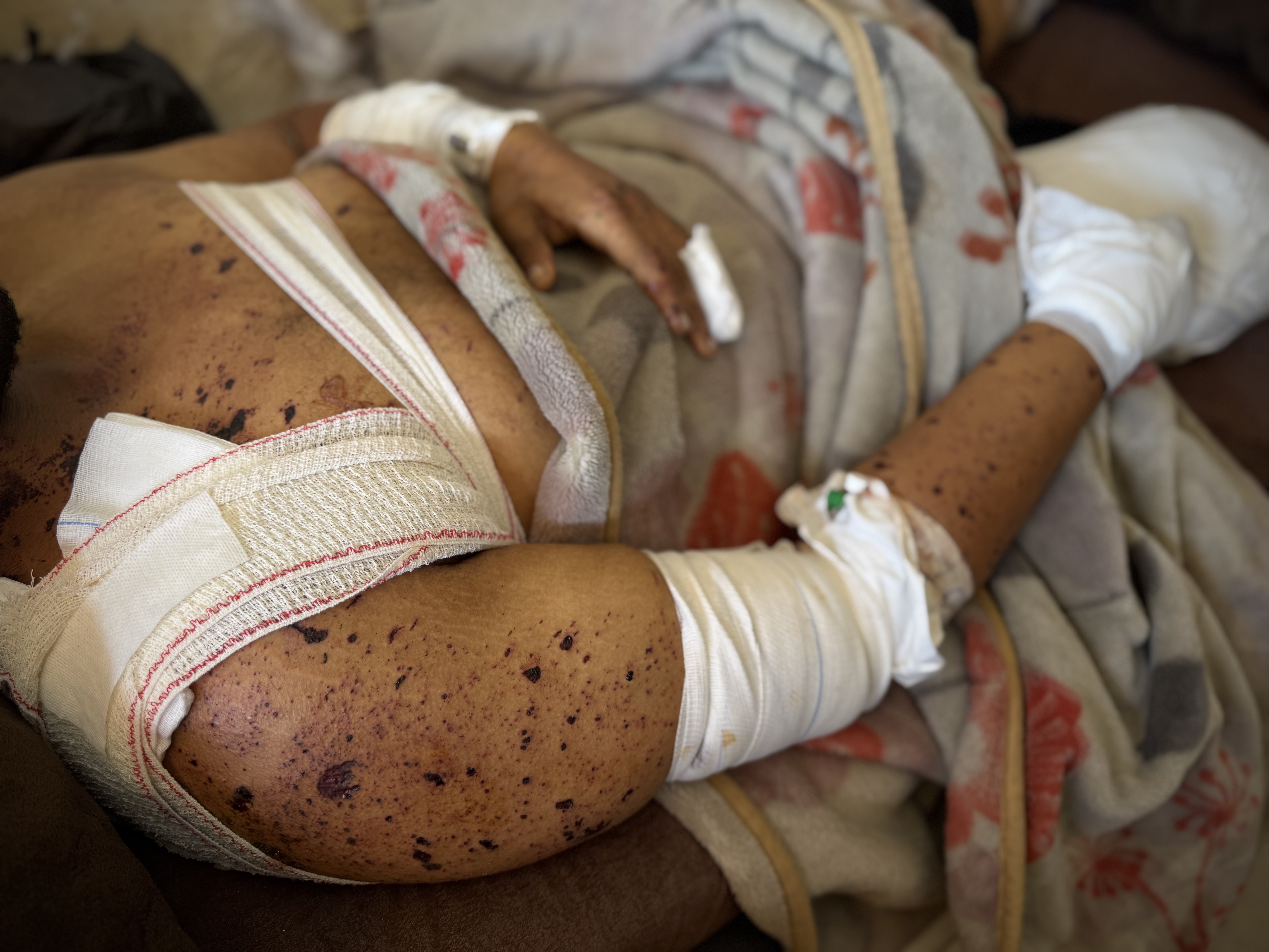 Gaza