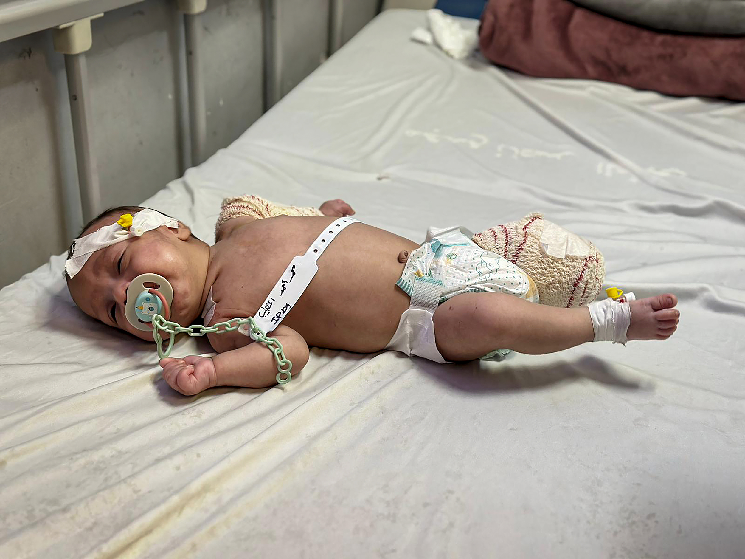 Two-month-old baby Ahmed al-Khatib had his leg amputated after an Israeli attack on al-Mawasi that also killed his mother