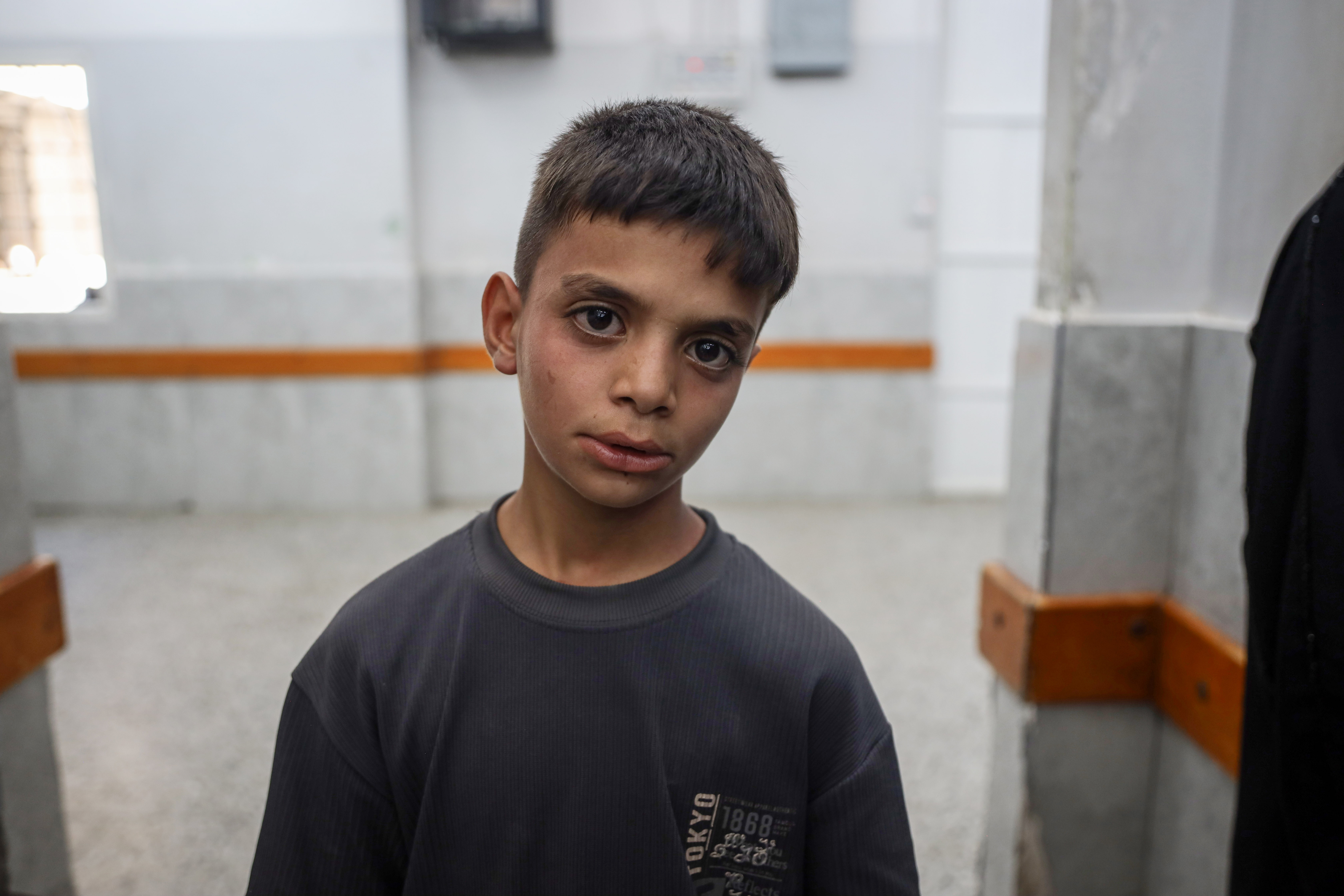 Hayat al-Ajlah’s 12-year-old son Yasser, who survived the building collapse in Gaza City