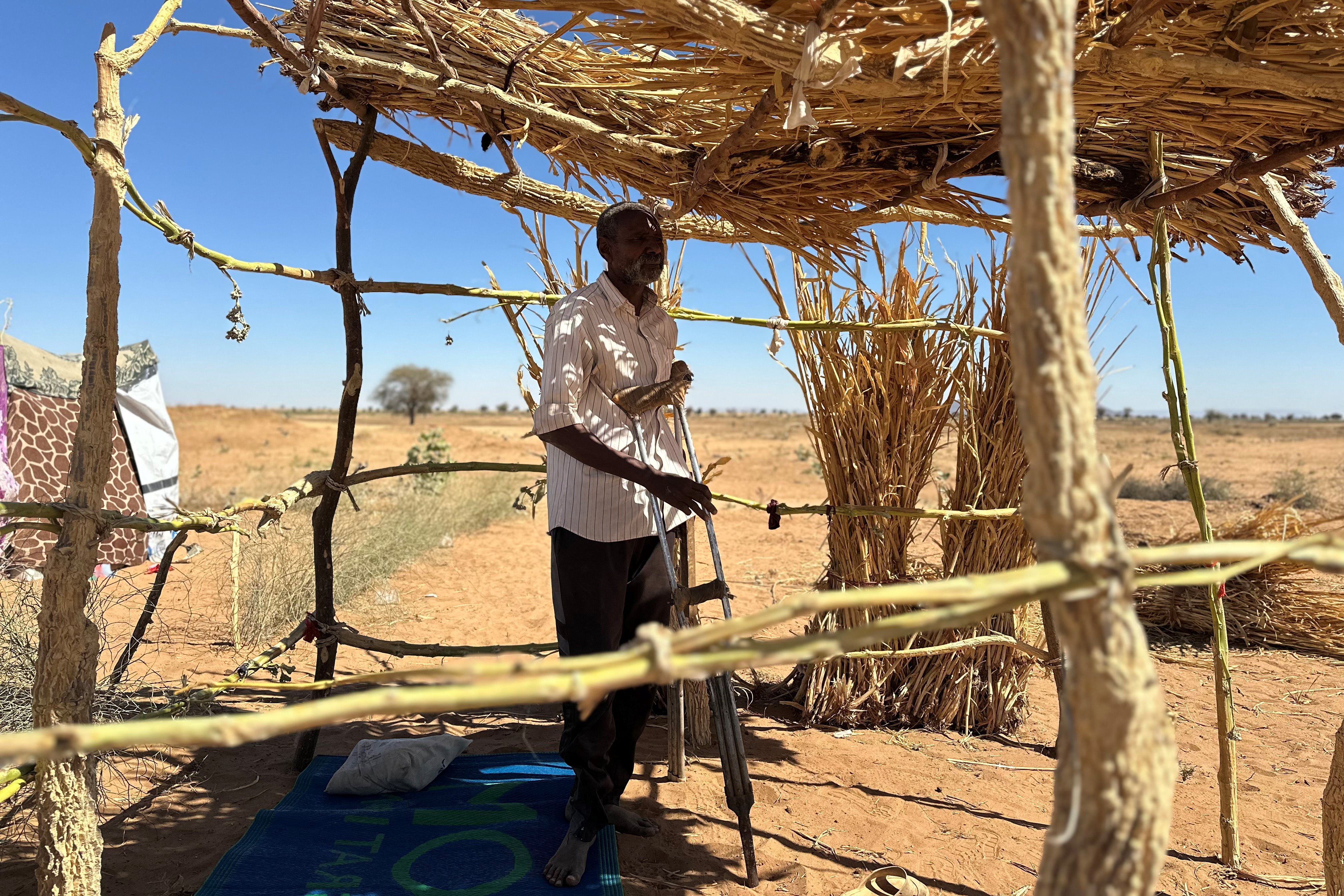 Sudanese displaced Ibrahim Noureldin, who says he was imprisoned and tortured in Rapid Support Forces' (RSF) prisons before fleeing El-Fasher, leans on crutches at a makeshift shelter in the town of Tawila, in war-torn Sudan's western Darfur region on March 2, 2026. Thousands of people are estimated to have been detained in the Rapid Support Forces' (RSF) October takeover of North Darfur's El-Fasher, a battle that a UN investigation found bore the "hallmarks of genocide". (Photo by AFP)